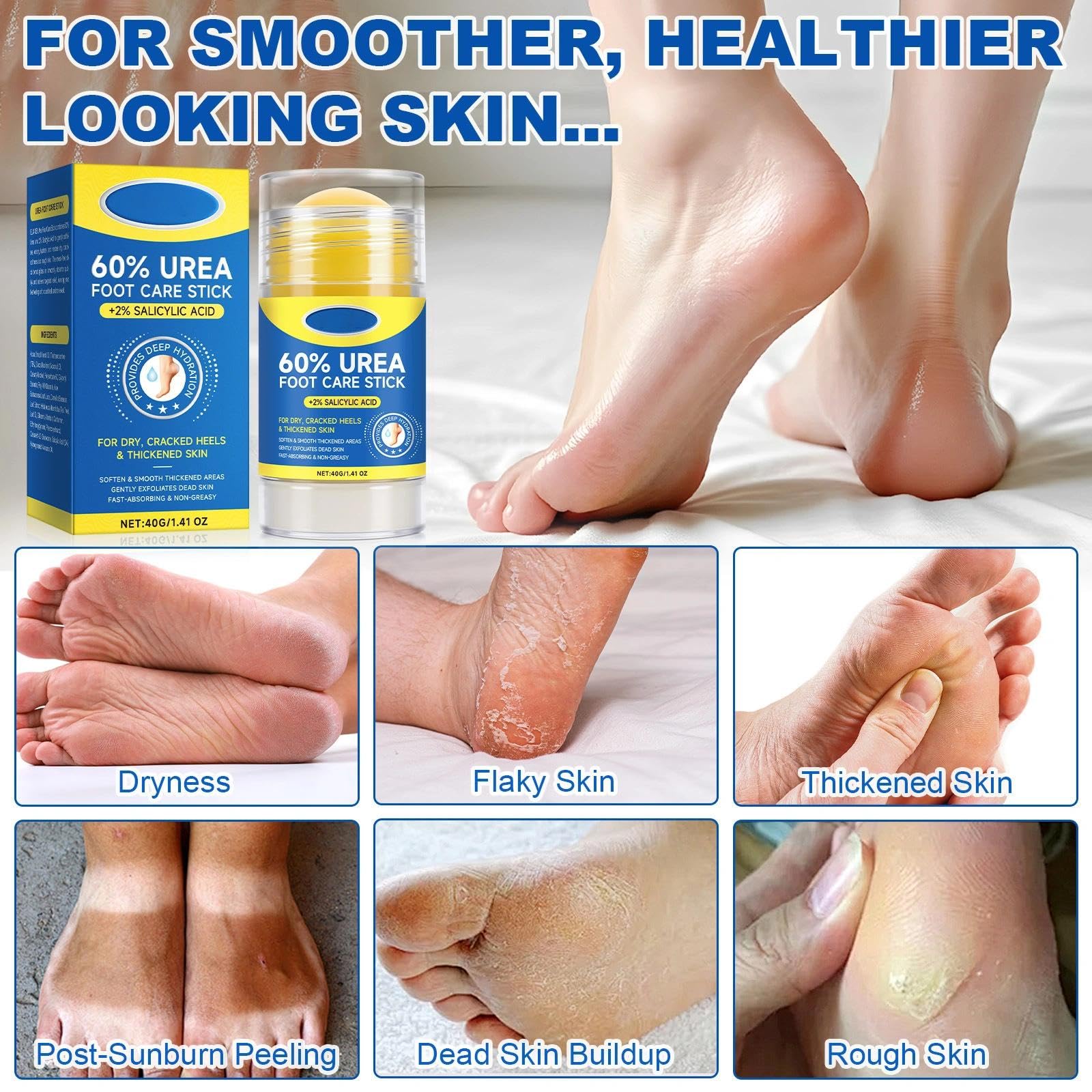 Urea Cream 60 Percent for Feet Foot Cream Stick, Intense Moisturizer for Cracked Heels & Dry Skin - Image 4