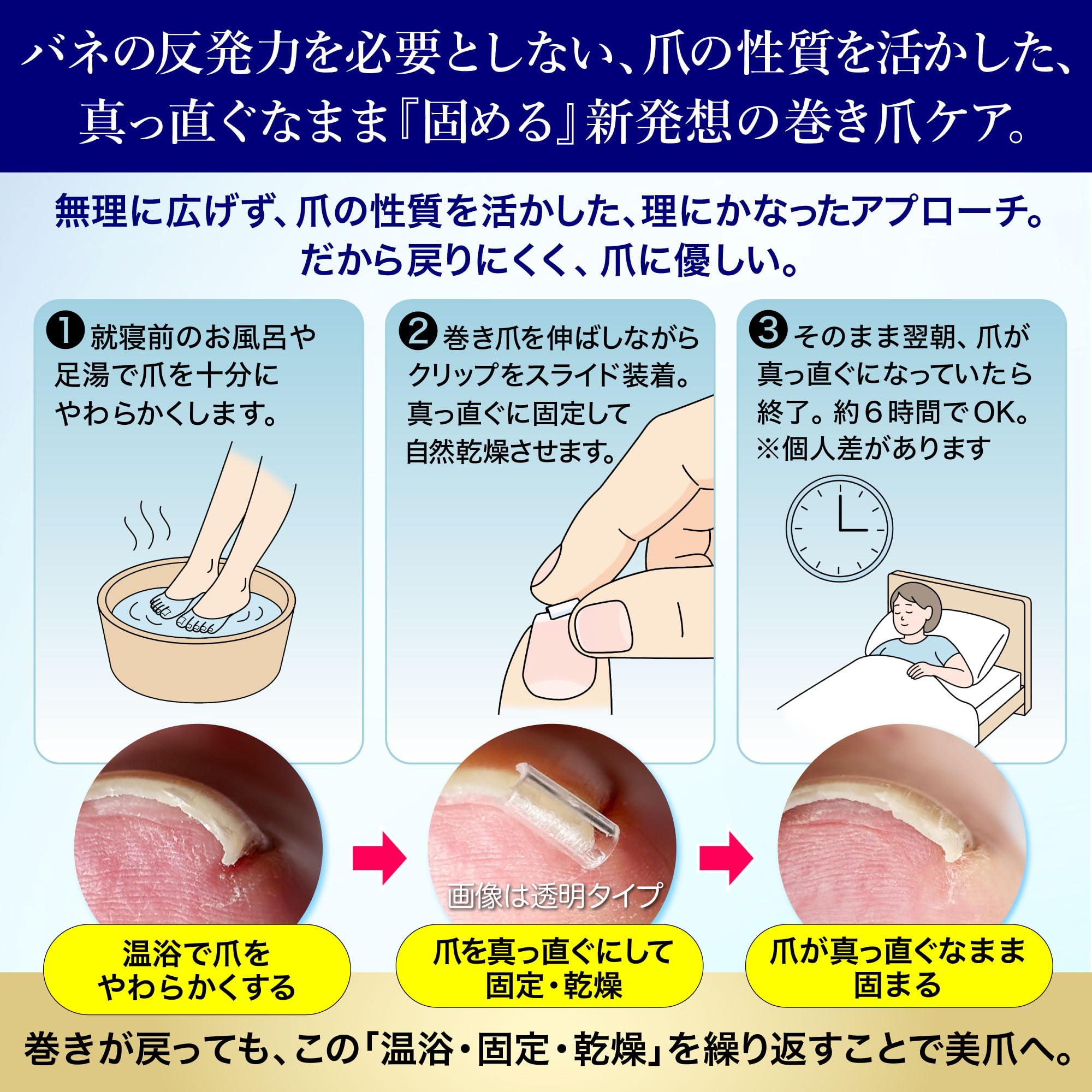 Amazon | CURL NAIL 巻き爪クリスタルケア【巻き爪もトゲも「温浴