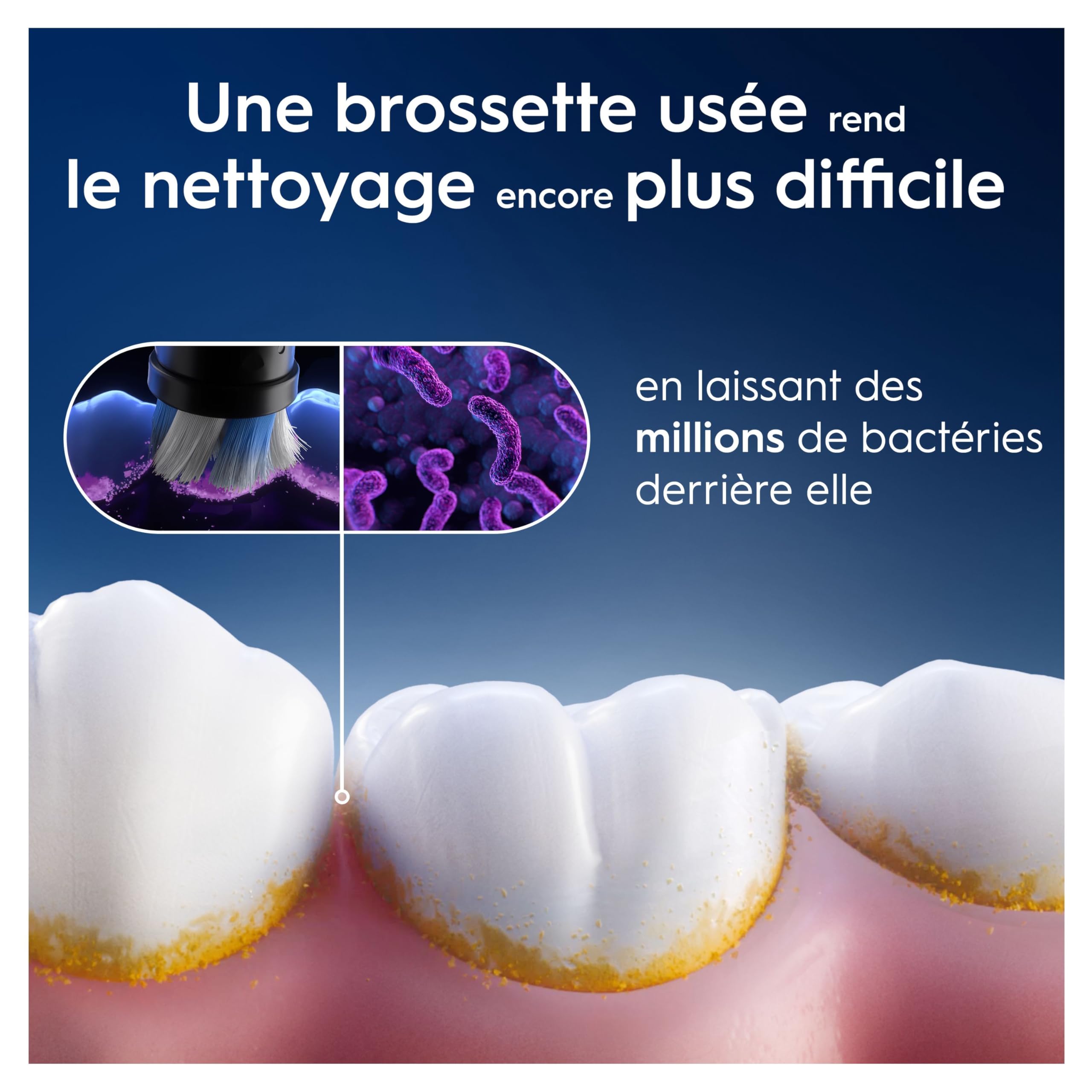 Oral-B Brossettes de Rechange Radiant White, lot de 4, Noires – Recharges Brosse à Dents Électrique iO, pour Adultes, Tête Ronde de Polissage Blanchissant