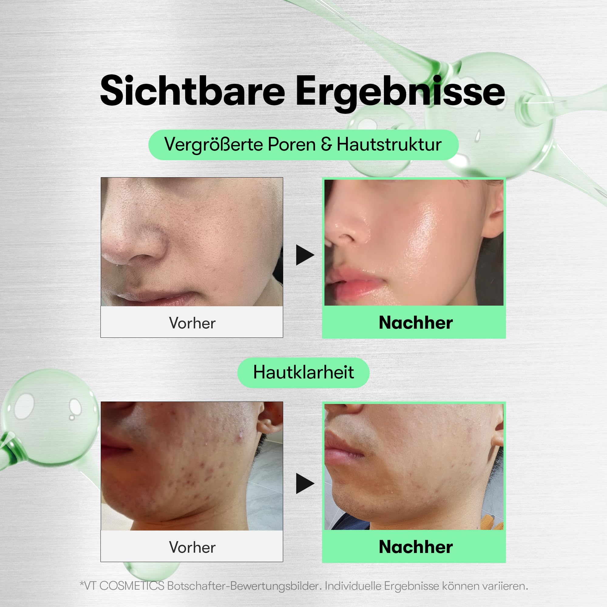 VT COSMETICS CICA Reedle Shot 100, Spicule Mikronadel-Serum für Porenpflege & Peeling, Exosom, Centella Asiatica für Glas-Haut, Hautstruktur(1,69 Fl Oz / 50ml)