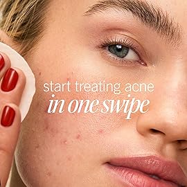 First Aid Beauty Acne Pads for Face - Maximum Strength Acne Treatment - 2% Salicylic Acid Pads Treat Without Drying, (60-ct)