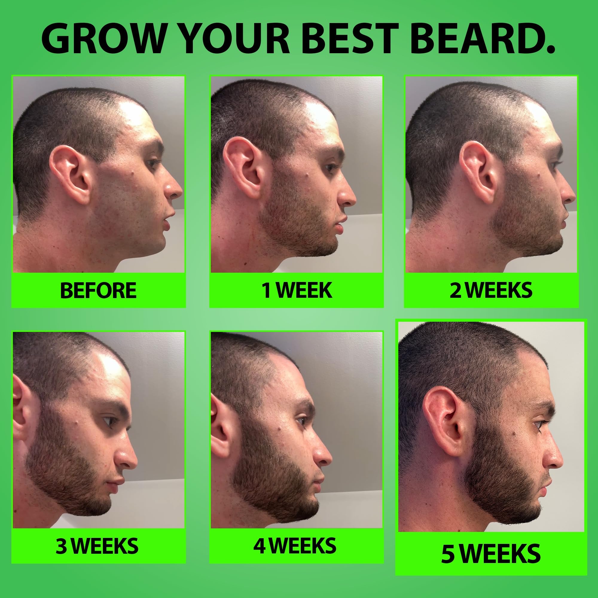 Beard GROW XXL & Beard Minoxidil Bundle for Men – Beard Growth Oil + 5% Minoxidil Serum with 2X Biotin & Rice Water – Thickens, Fills Patchy Areas & Promotes Fuller Facial Hair