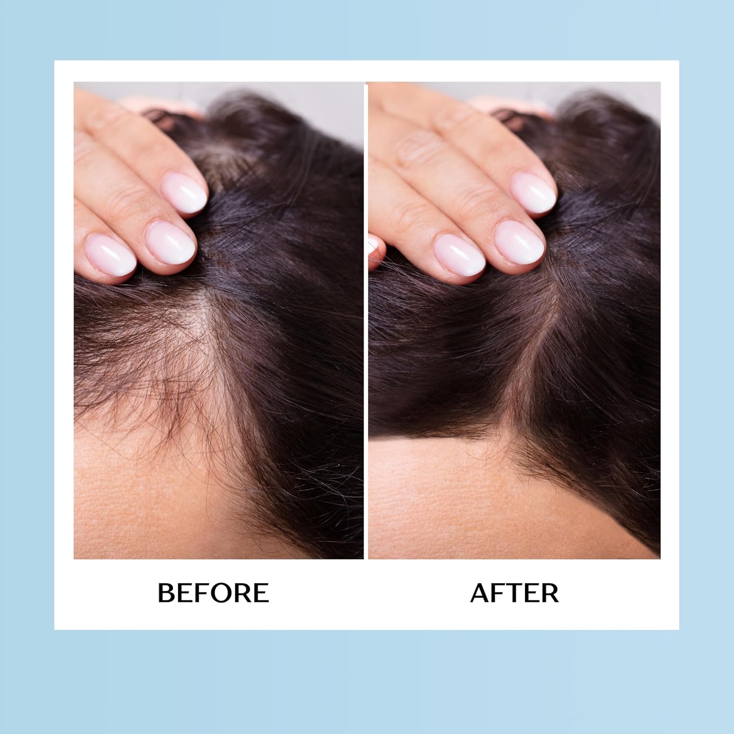 Mediceuticals HairGain Dietary Supplement Natural Phytoflavone DHT Inhibiting Complex for Healthier Hair Growth, Vitamin D (w/Sleek Comb) Gain Pills Tablets Vitamins (60 Tablets for Women)