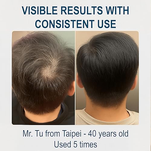 Miniatura 3 de LA EXO Solución bioquímica para el cuidado del crecimiento del cabello con exosoma de pulso para la densidad del cabello, reduce la caída y promueve