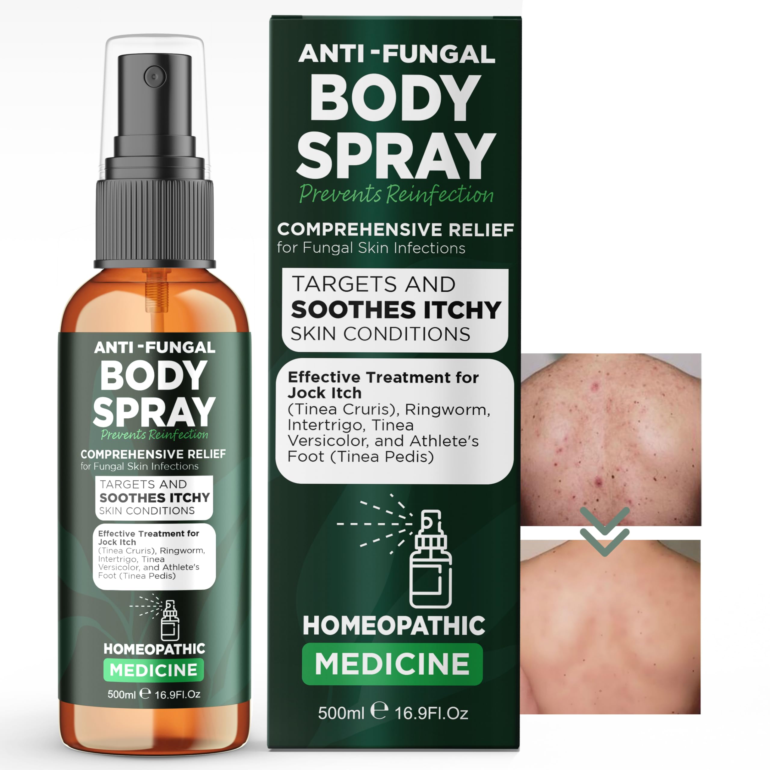 Buy AntiFungal Spray for Body Ringworm & Jock Itch , Odor Eliminator