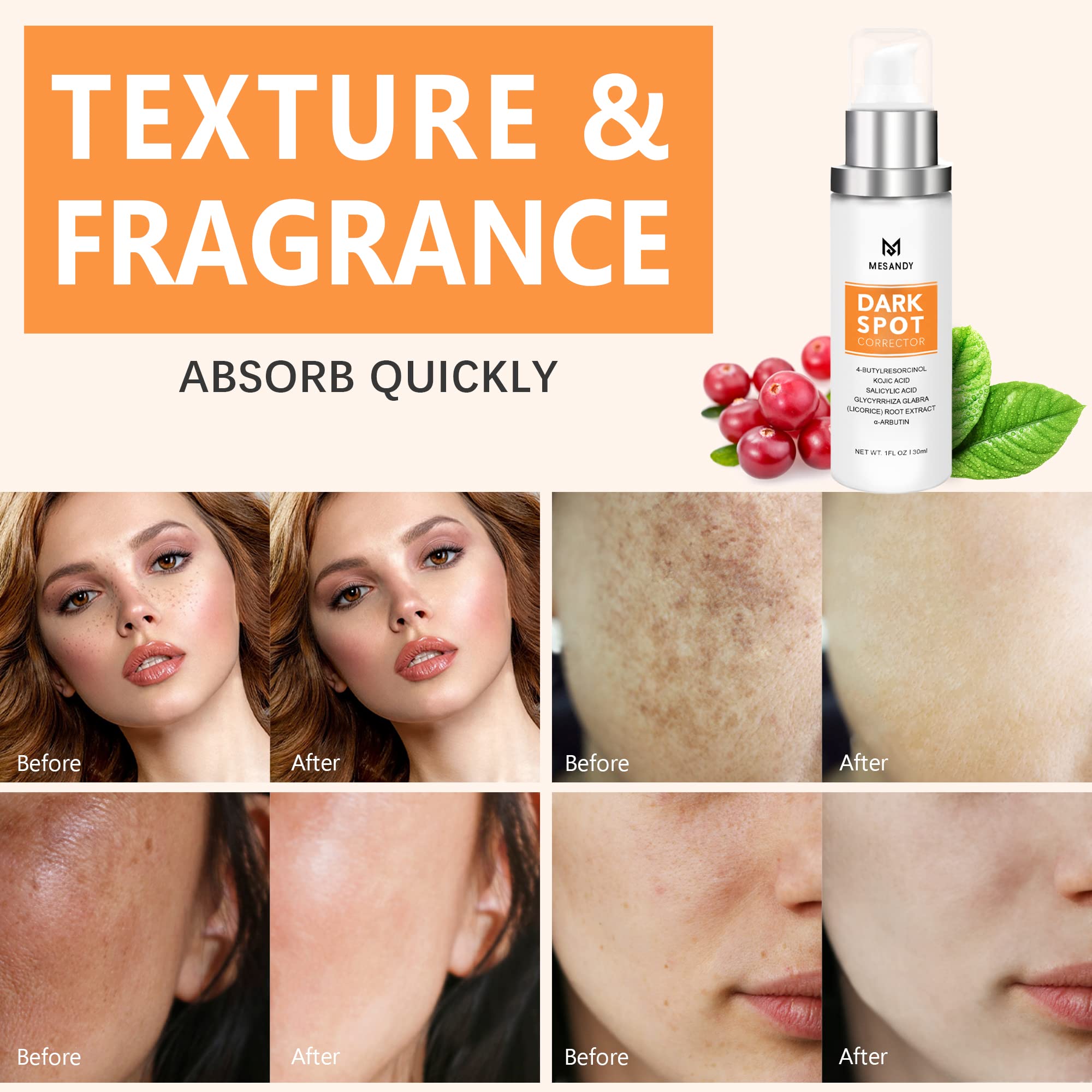 Buy MESANDY Dark Spot Corrector, Dark Spot Remover For Face and Body