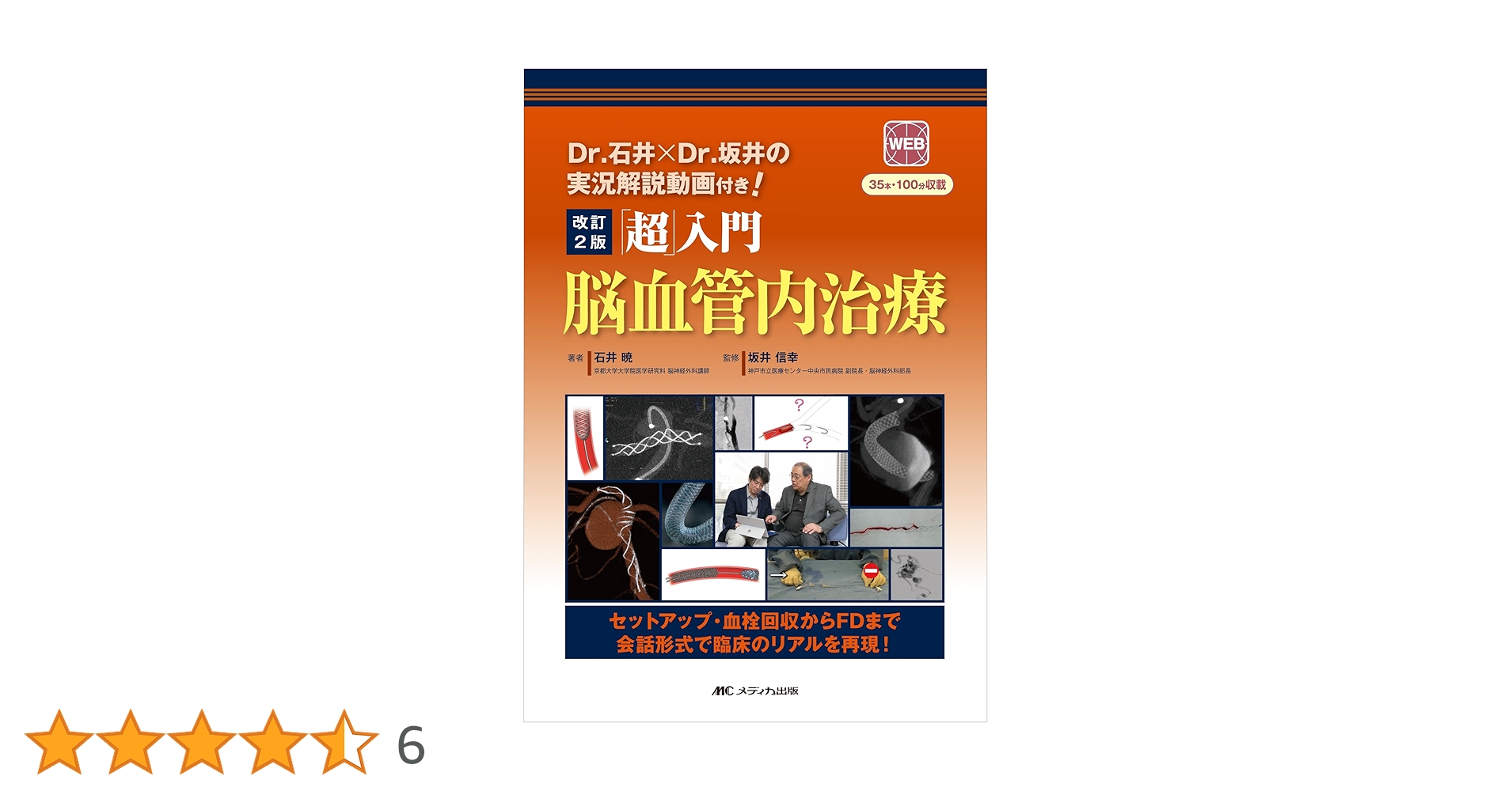 Amazon.co.jp: 改訂2版 「超」入門 脳血管内治療: Dr.石井×Dr