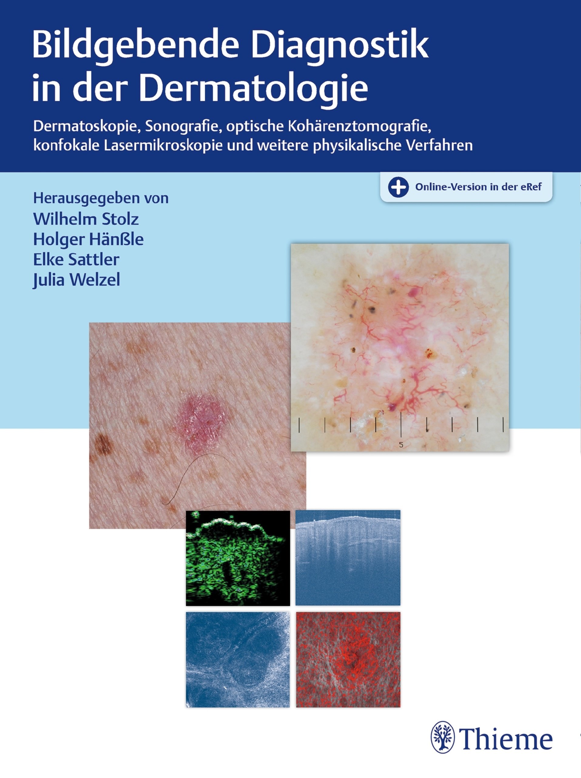 Bildgebende Diagnostik in der Dermatologie: Dermatoskopie, Konfokale Laserscanmikroskopie, Optische Kohärenztomografie, Sonografie