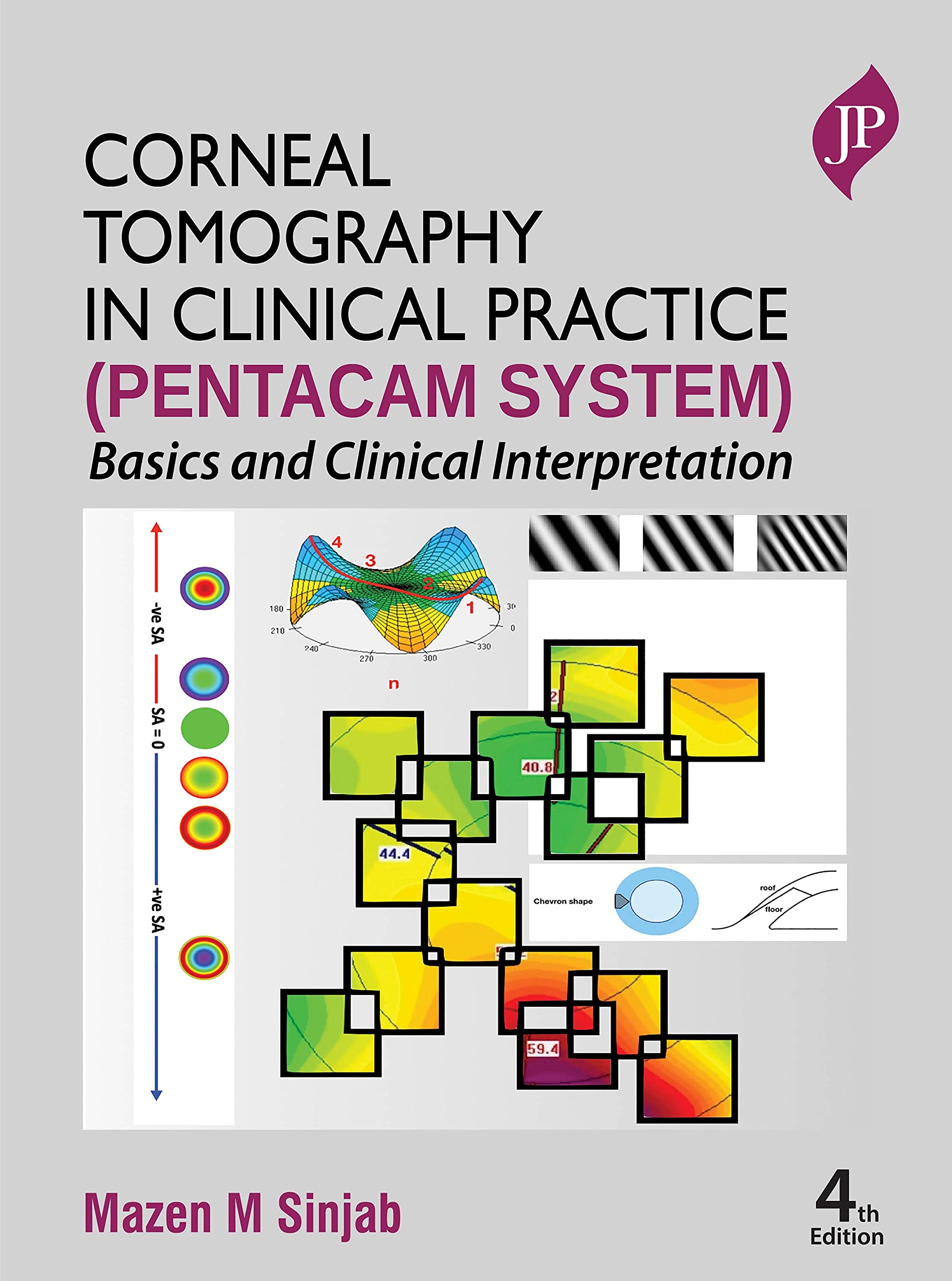 Corneal Tomography in Clinical Practice (Pentacam System): Basics and Clinical Interpretation (English Edition)