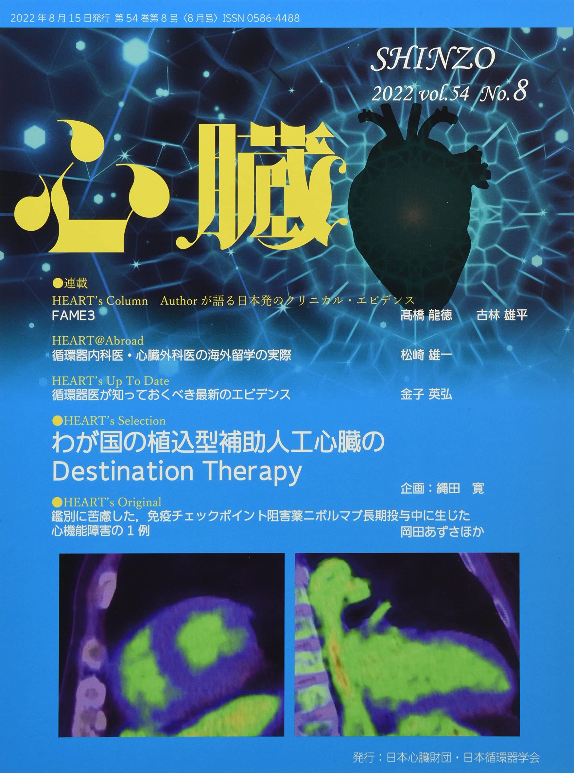 心臓 2022年 8月号 [雑誌] | 上原 雅恵, 縄田 寛, 網谷 英介, 甲斐沼