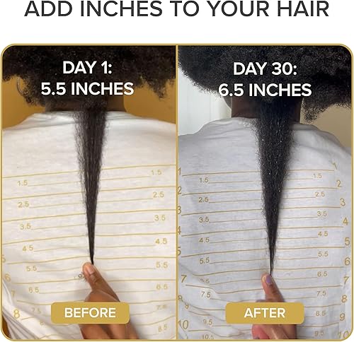 Miniatura 5 de Shedavi Vitaminas naturales icónicas para el cabello para un crecimiento rápido del cabello, suplementos puros para el cabello formulados con