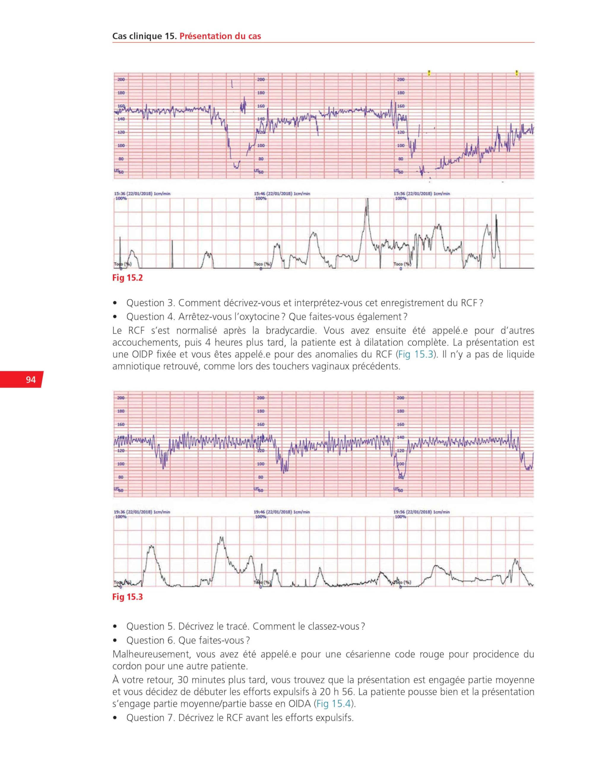 Analyse pratique du RCF : rythme cardiaque foetal: Méthodologie et cas cliniques commentés