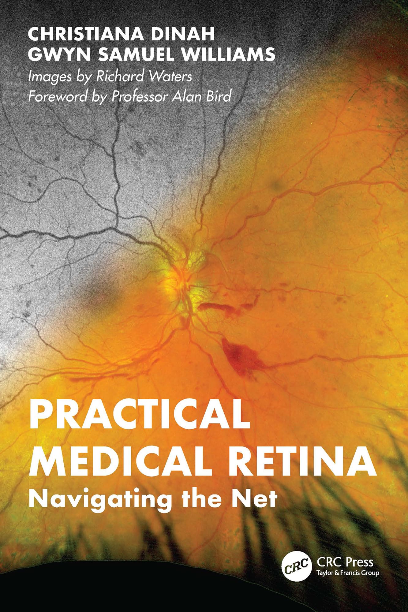 Practical Medical Retina: Navigating the Net (English Edition)