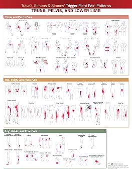 Travell, Simons & Simons Trigger Point Pain Patterns Wall Chart Trunk, Pelvis, and Lower Limb