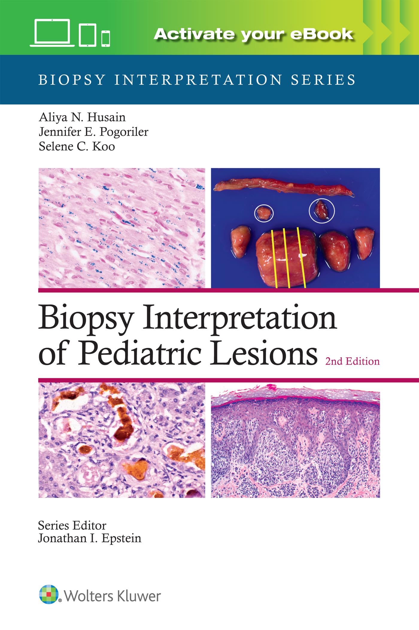 Biopsy Interpretation of Pediatric Lesions: Print + ---- wit... - 9781975213268