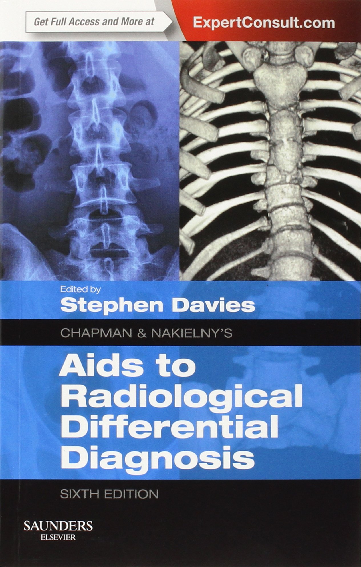 Buy Chapman & Nakielny's Aids to Radiological Differential Diagnosis: Expert Consult - Online and Print — BookShops.in