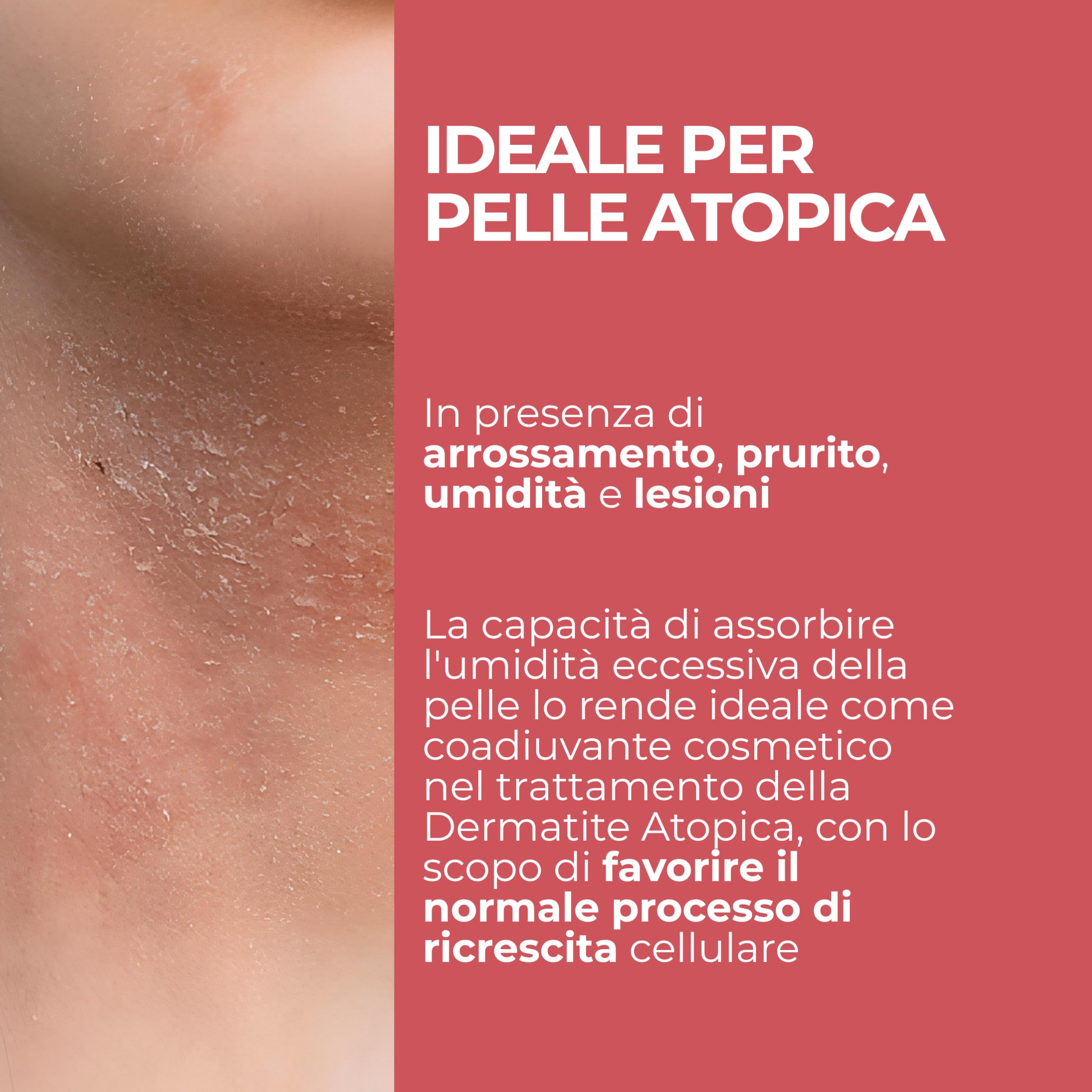 MOST - PEG Unguento Viso e Corpo Bambini e Adulti Lenitivo e Protettivo, Diminuisce Rossori e Stimola Processi di Riparazione Cutanea in Ragadi, Scottature Lievi, Cicatrici, Dermatite Atopica, 100 ml