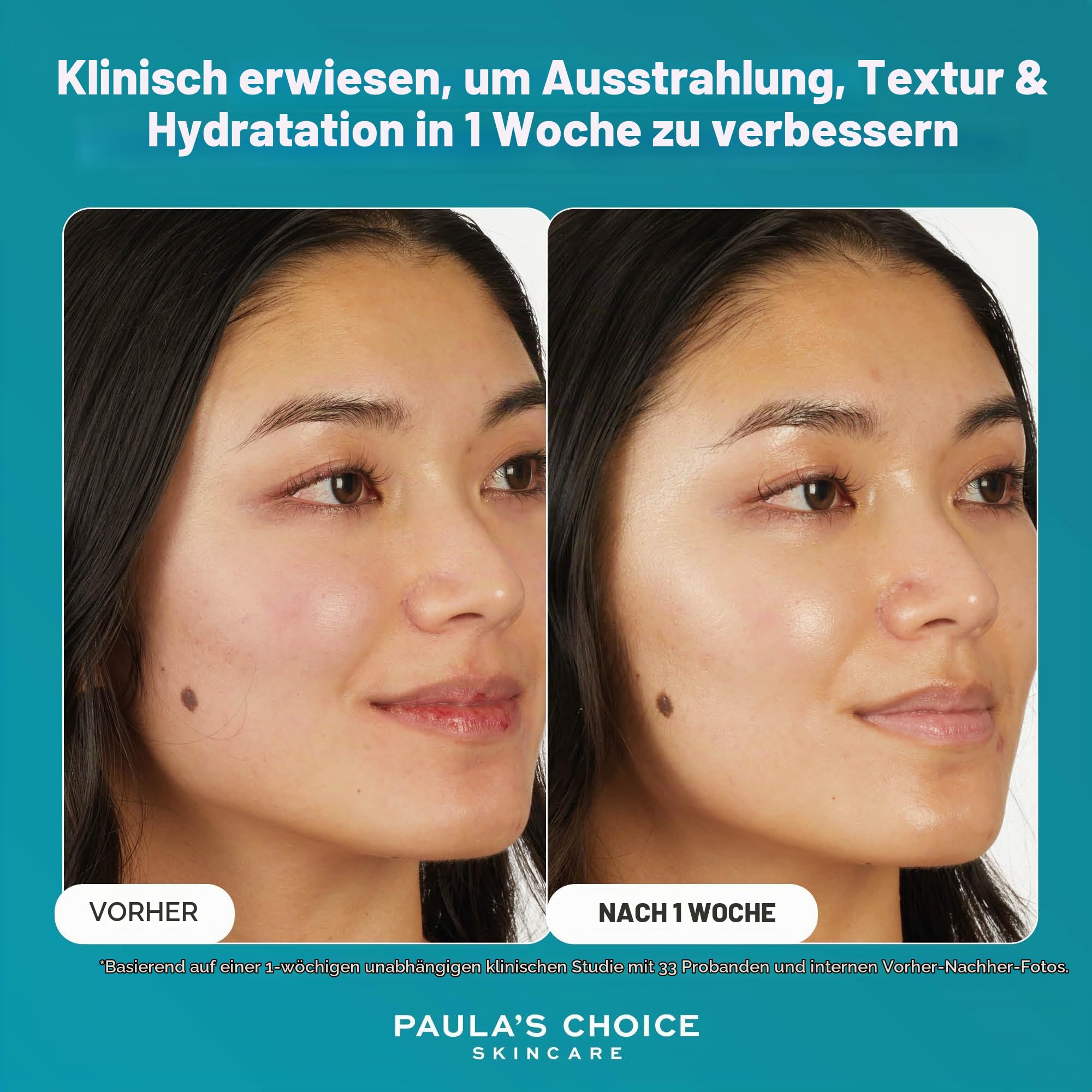 Paula's Choice 7% Ectoin + Hyaluronsäure Milky Hydrating Serum, 20 ml | Milchiges Feuchtigkeitsserum - 7 Barriereschutz-Vorteile in einem Tropfen - Beruhigt & Schützt die Haut - Rosazea-Empfindlich