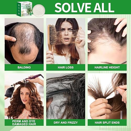 Miniatura 8 de Juego de 2 barras de champú y acondicionador de aceite de romero para hombres y mujeres, fortalece el cabello, espesa las hebras, controla el