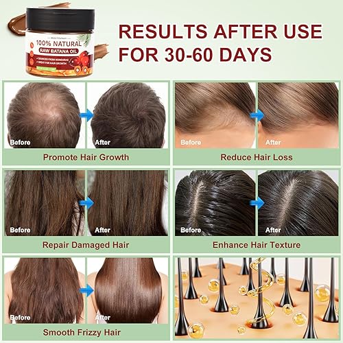 Miniatura 4 de Aceite de batana crudo para el crecimiento del cabello, aprobado por el Dr. Sebi, aceite de batana orgánico sin refinar 100% natural procedente de