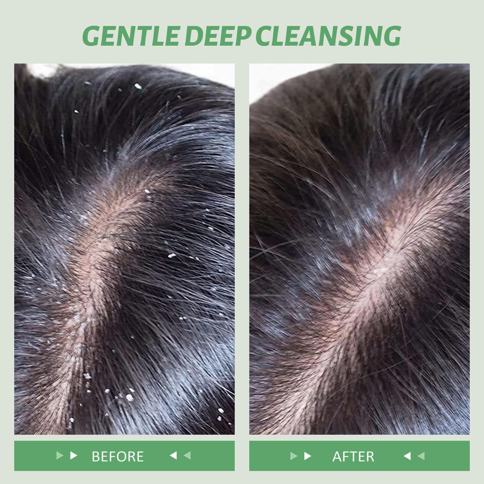 Rosemary Scalp Scrub,Deep Cleansing & Exfoliating Scalp Treatment for Dandruff & Oily Scalp - Image 4