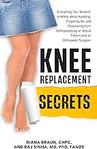 Knee Replacement Secrets: Everything You "Knee'd" to Know About Avoiding, Preparing For, and Recovering From Arthroplasty by an Actual Patient and an Orthopedic Surgeon