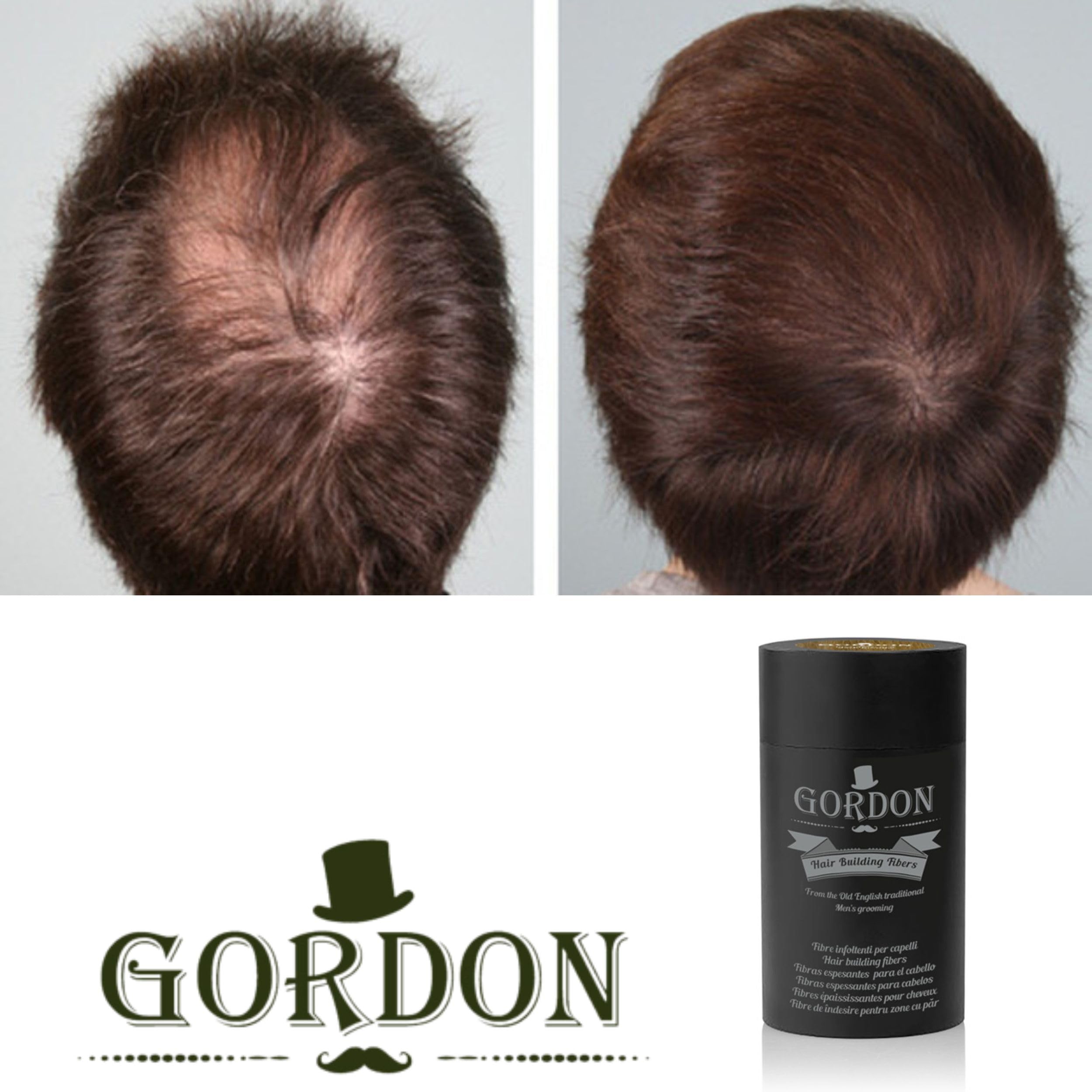 Fibre per capelli Gordon Set 2 Confezioni da 22 Grammi, copertura istantanea per il diradamento. (2 x Castano Scuro Senza Applicatore)
