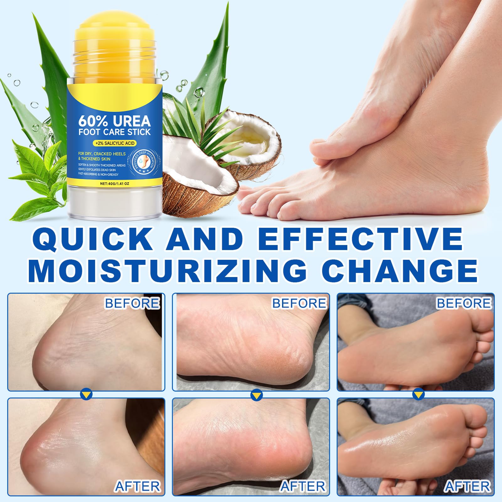 60% Urea Cream Stick with Salicylic Acid 2%, Urea Hydrating Foot Cream, Severe Cracked Heel Repair Restoring Balm, Foot Lotion Repairs and Hydrates Dry and Feet and Hand