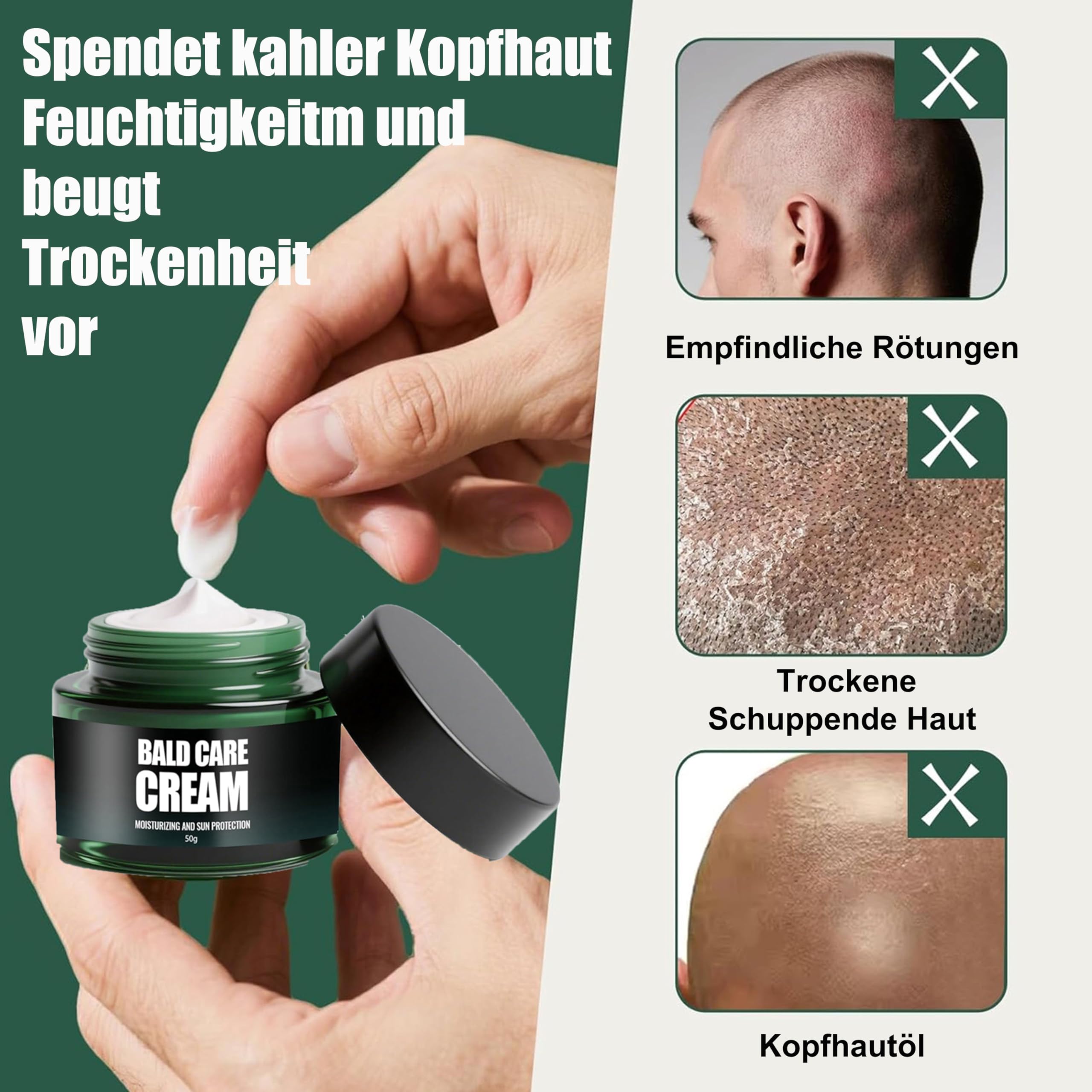 Krem do łysienia – 1 x krem do pielęgnacji skóry głowy, nawilżający, pielęgnujący i pielęgnujący skórę głowy, naturalny krem do łysienia dla mężczyzn, krem do pielęgnacji włosów