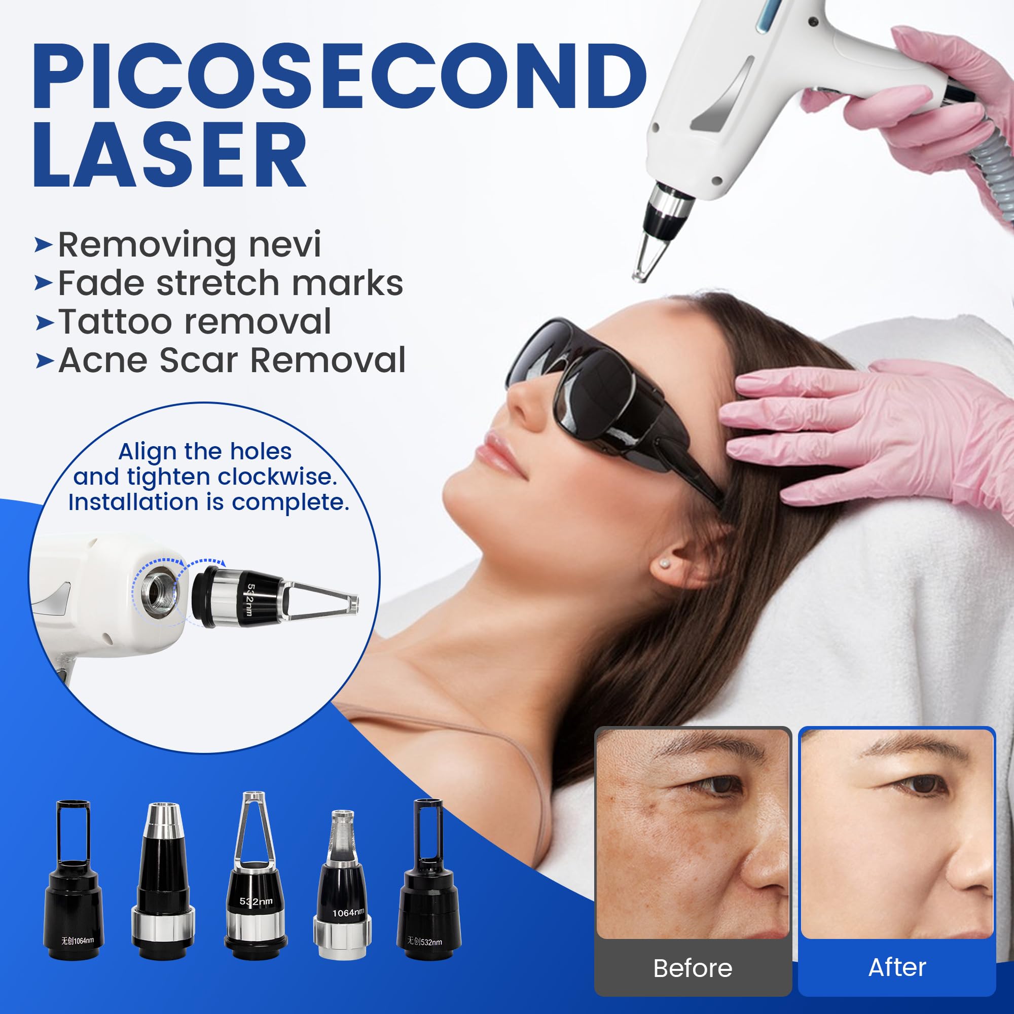 10Bars 2 in 1 Epilatore Laser 808nm a Diodo, Picosecondo Rimozione tatuaggi | 755nm/808nm/940nm/1064nm Rimuovere i peli superflui da tutto il corpo Rimozione di nei e cicatrici da acne