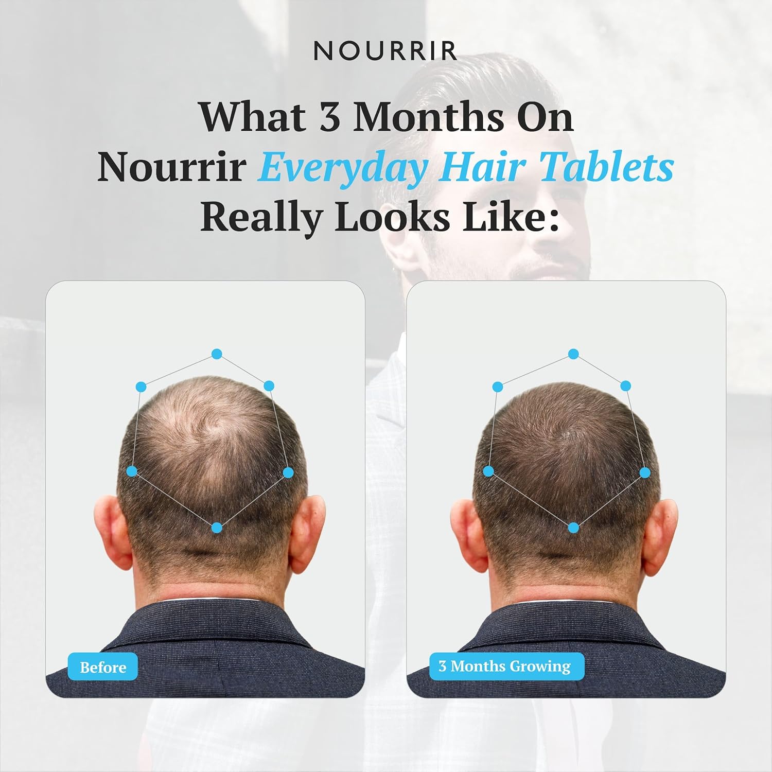 Men's Hair Growth Tablets - Biotin, DHT Blockers, Vitamins - Promotes Thick Hair, Balances Hormones 24 Count (Pack of 1) White