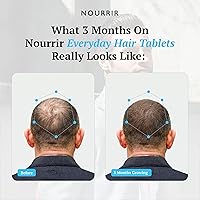 Vista 5 de Tabletas de crecimiento del cabello para hombres, biotina, bloqueadores de DHT, vitaminas, promueve el cabello grueso, equilibra las hormonas, 24
