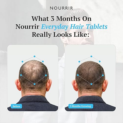 Miniatura 5 de Tabletas de crecimiento del cabello para hombres, biotina, bloqueadores de DHT, vitaminas, promueve el cabello grueso, equilibra las hormonas, 24