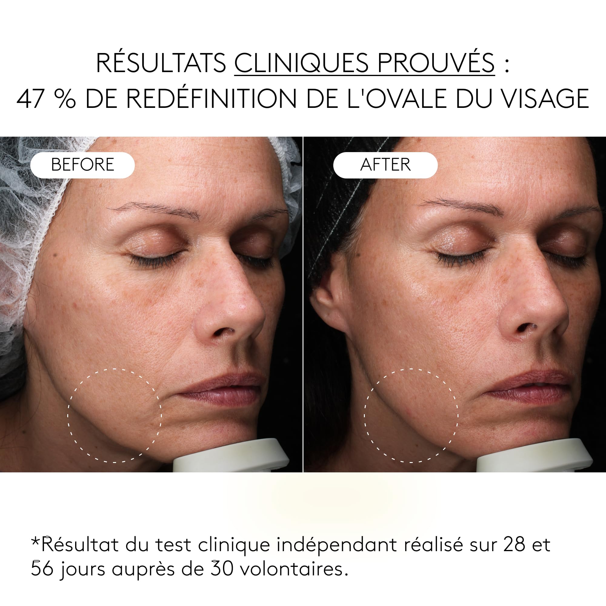COCUNAT Clinical Exosomes Sérum Visage Anti Ride V-Lifting 30 ml | Sérum anti-âge à action raffermissante. Élimine les rides, redonne de l'élasticité et redéfinit l'ovale en 8 semaines.