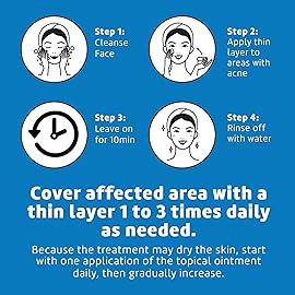 De La Cruz 10% Sulfur Ointment - Cystic Acne Treatment for Face and Body - Daily 10 Min Spot Treatment Mask Safe and Effective Game Changing Hormonal Acne Treatment that Clears Up Pimples 2.6oz 4 Pack