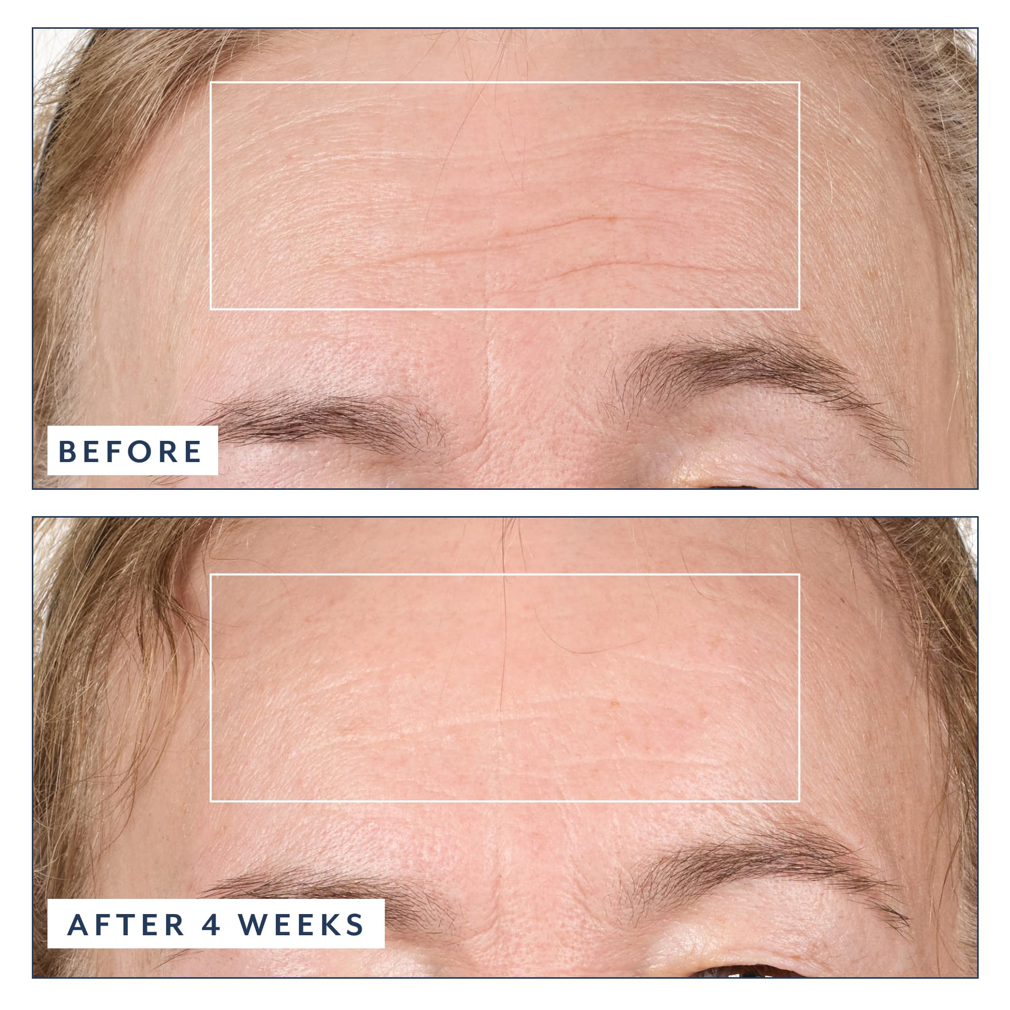 Bloomeffects Black Tulip Regenerative Serum with Exosomic Peptides