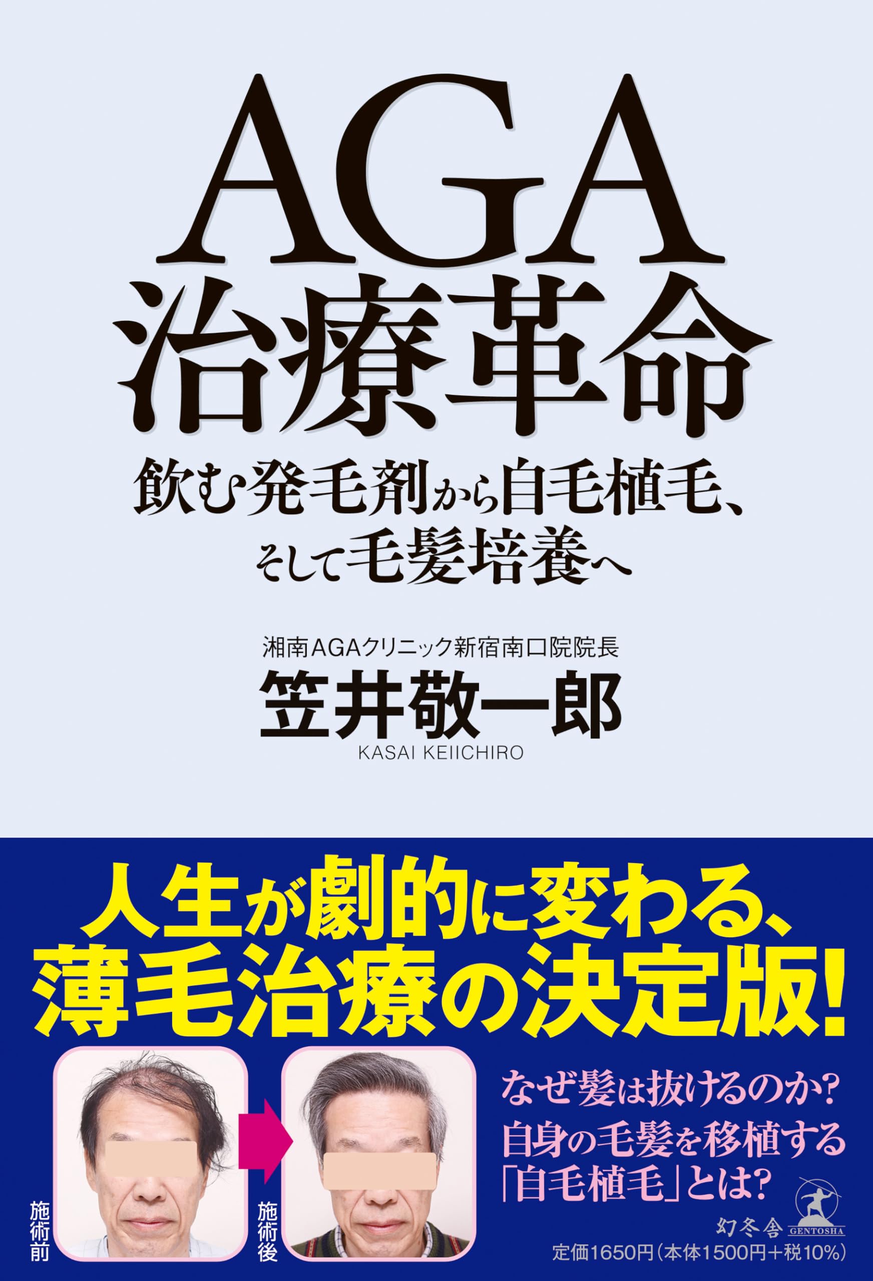 AGA治療革命 飲む発毛剤から自毛植毛、そして毛髪培養へ | 笠井 敬一郎
