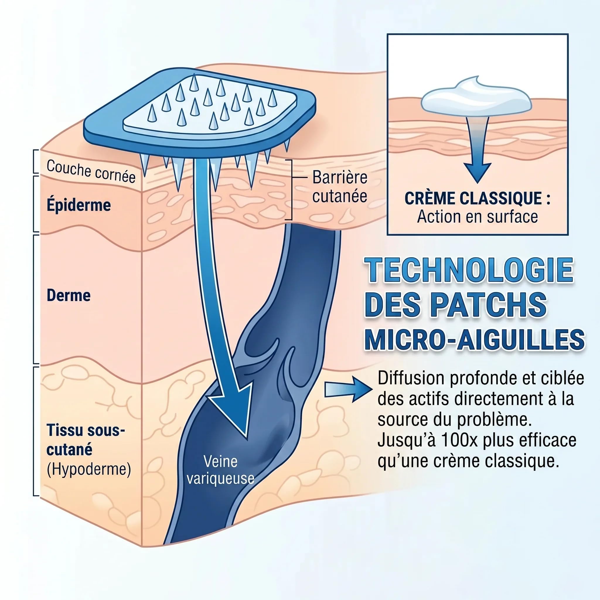 vaduma Patch Anti-Varices Patchs nourrissants pour les jambes - Soins de peau pour stimuler la mobilité - Ensemble de 12 patchs avec absorption profonde - Coussinets de traitement aux extraits