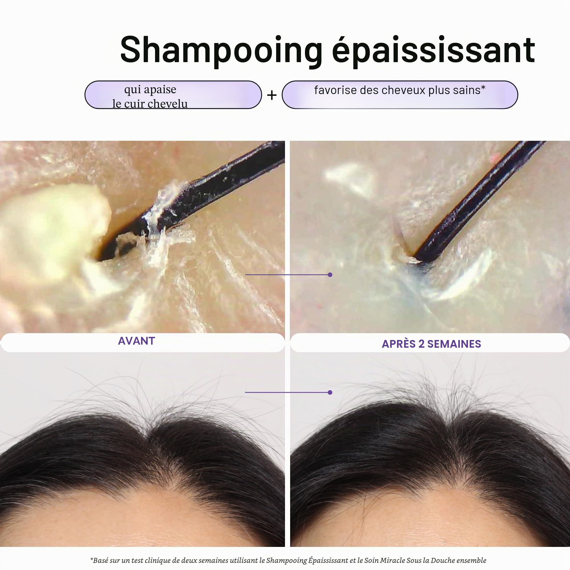 Dr. Groot Solution revitalisante pour le cuir chevelu | Shampoing épaississant Aide cliniquement à volumiser visiblement les cheveux fins, abîmés ou secs, 385 ml