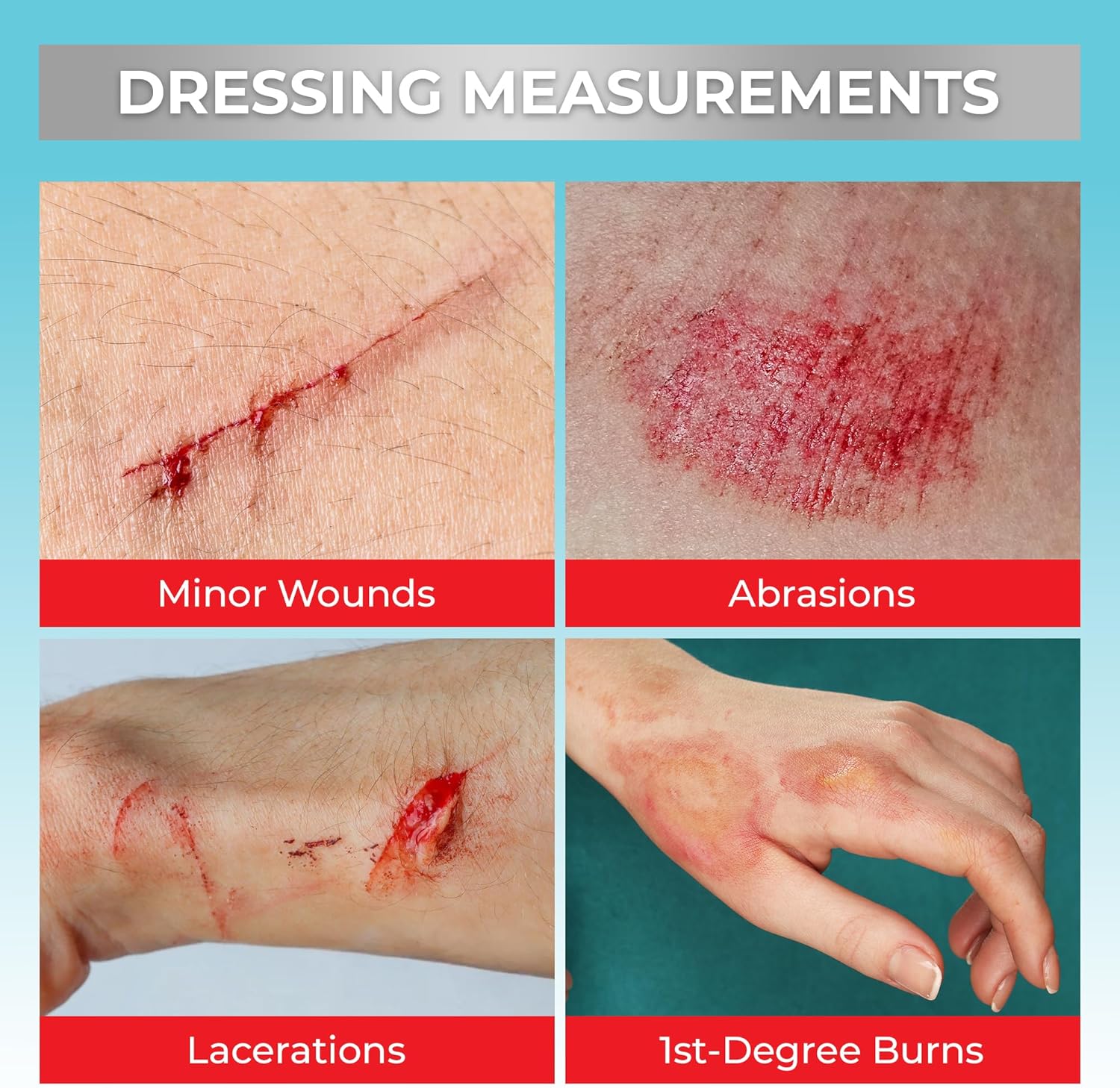 SilverSeal Hydrogel Burn & Wound Dressing Kit with X-Static Silver - FDA Cleared Care for Burns, Cuts & Wounds – Soothing Moisture, Relief & Protection - 4 (2”x3”) Hydrogels + 4 (3”x5”) Adhesive Pads - Image 5