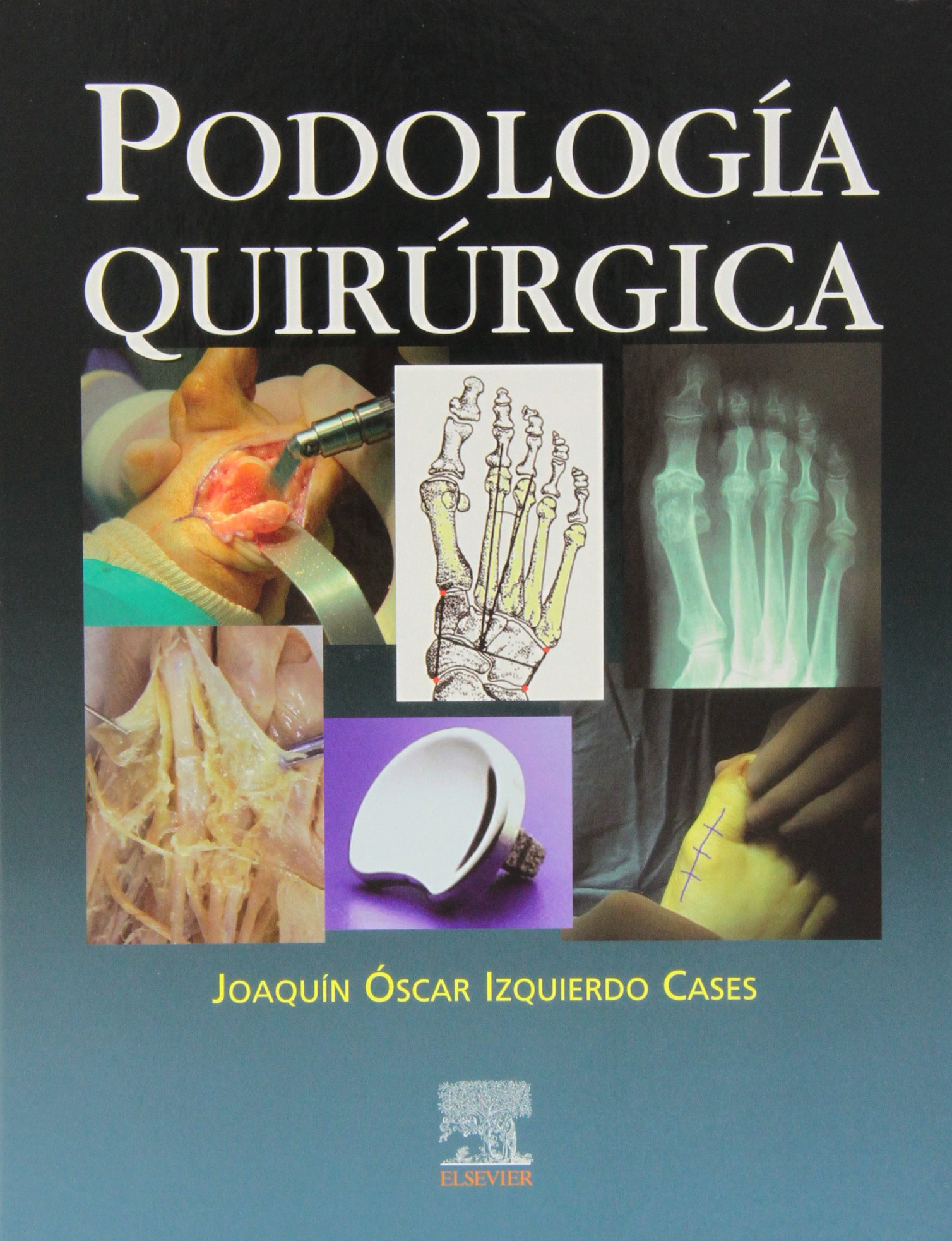 Podología quirúrgica