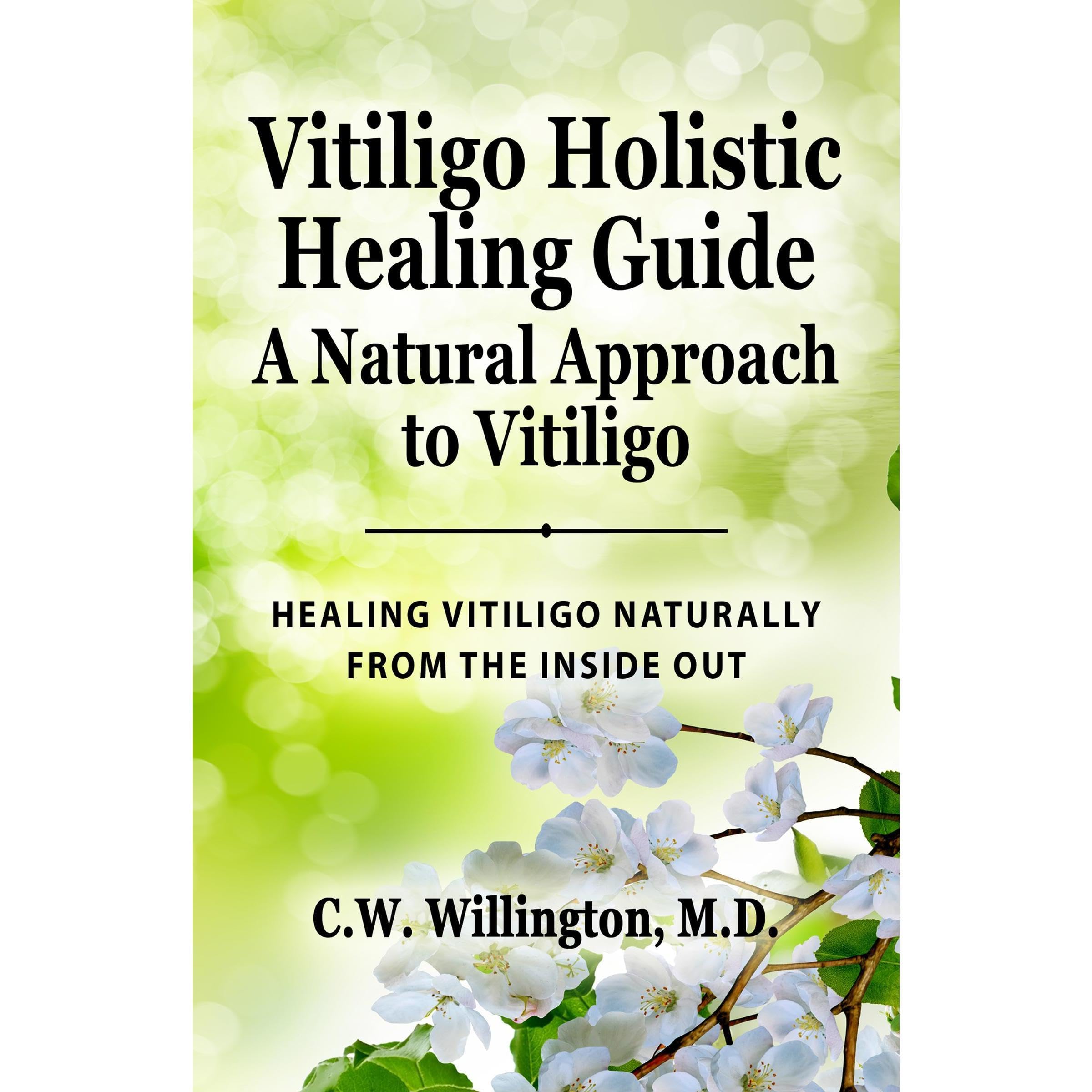 Vitiligo Holistic Healing Guide - A Natural Approach to Vitiligo