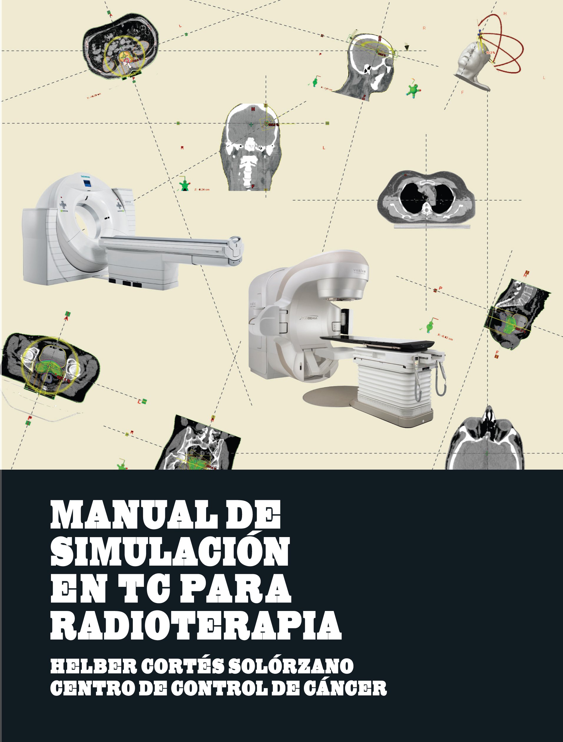 Manual de Simulacion en TC para Radioterapia (Spanish Edition)