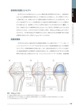 劇的に集患！４スキームテクニック 動画で学ぶ 患者さん満足度向上のためのTKA・UKA インプラント