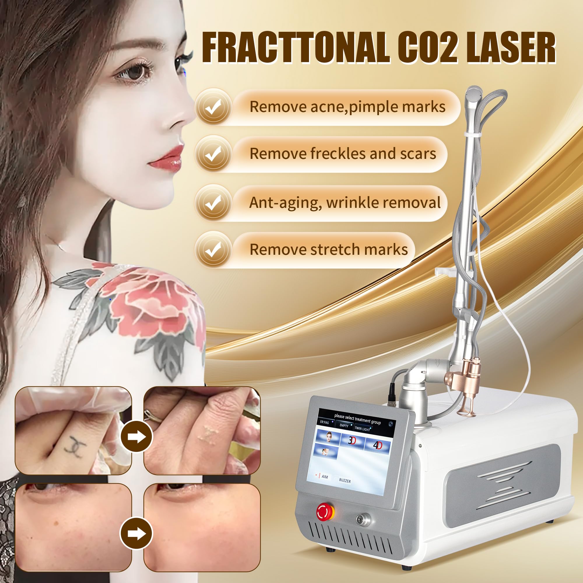 Dispositivo laser frazionale CO2 professionale per trattamenti di bellezza