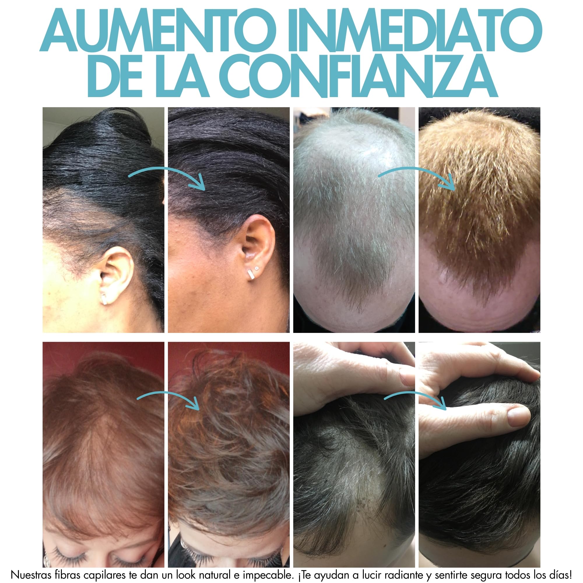 Hair Genetics Fibras Capilares Pack de Recarga – Fibra Capilar Natural para Cabello Fino y Caída del Cabello, Cobertura Instantánea y Volumen para Hombres y Mujeres, Fibras Capilares (Negro 50g)