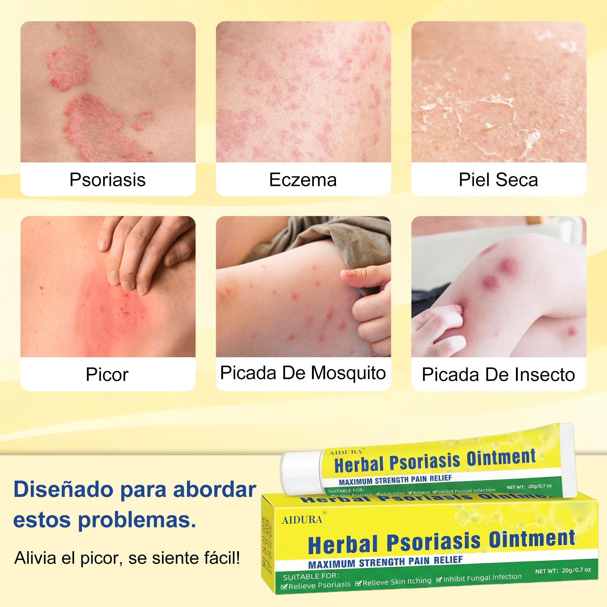 Crema para la Psoriasis,Crema Antipruriginosa 20g,Alivio del Picor y la Descamación,Cuidado Corporal para Pieles Muy Secas y Sensibles - 3