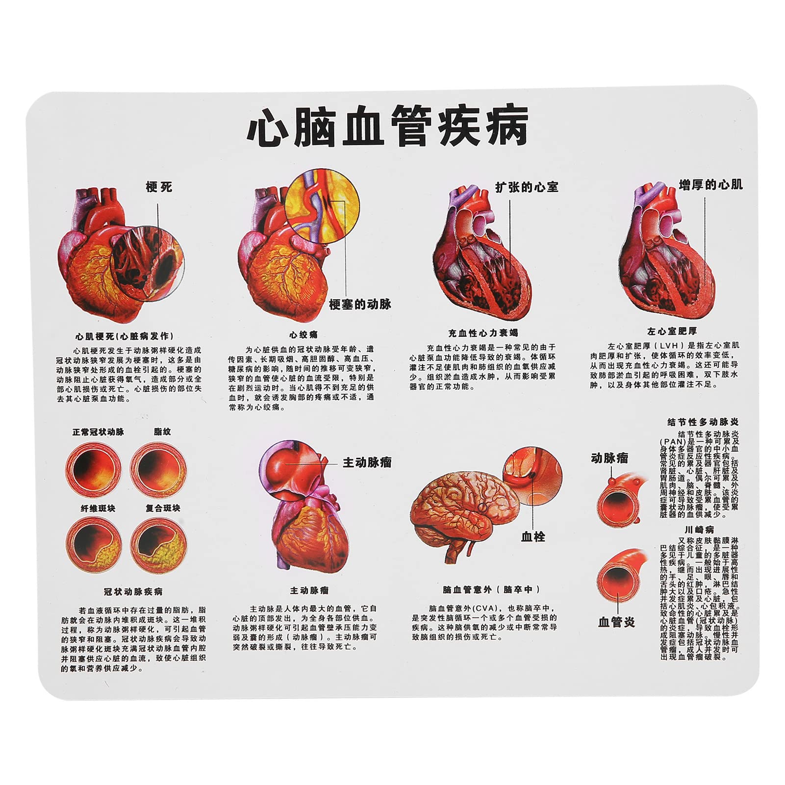 Yinhing 2X Dimensioni Reali Modello Cuore Umano Struttura Anatomica