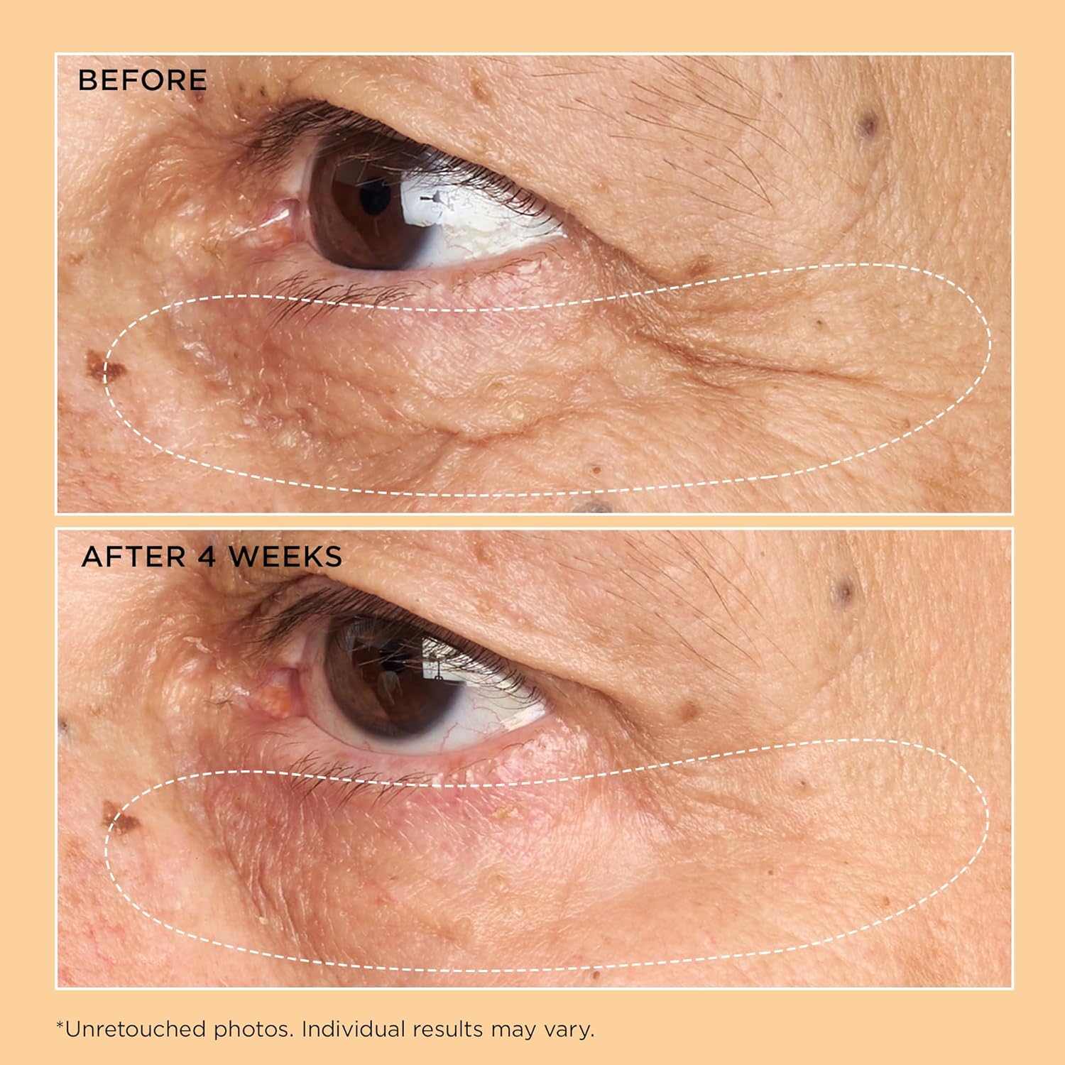 Perricone MD Neuropeptide Corrective Brightening Under-Eye Cream, 0.5 fl oz.