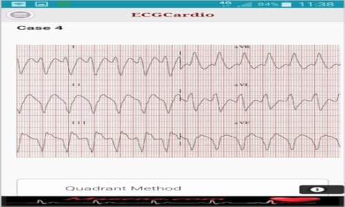 ECGCardio